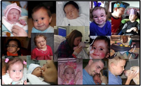 Kids with extra chromsomes