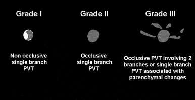 portal-vein-thrombosis-grade