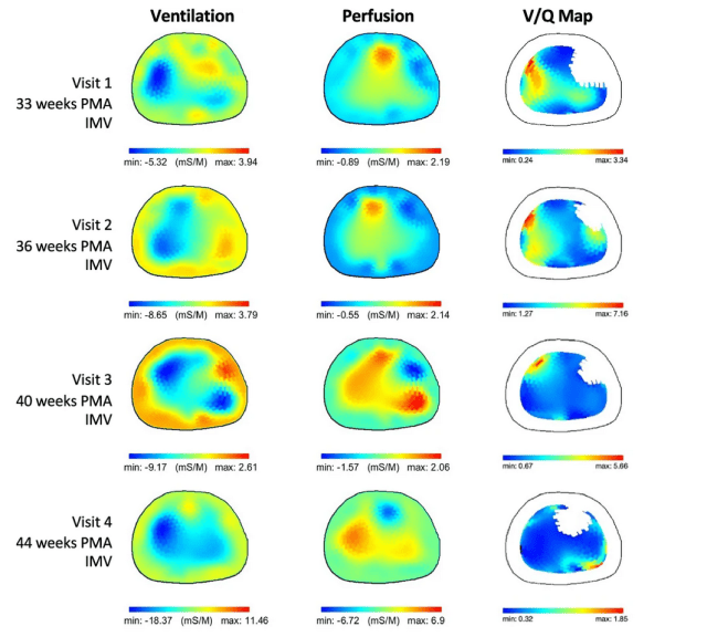 Neonatal Research | Following important research in neonatology ...